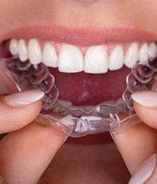 Woman inserting aligner for ClearCorrect in Sugarland. 