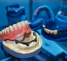 a model of an implant denture sitting on a mold