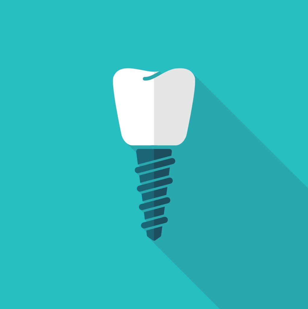 Dental implant drawing.